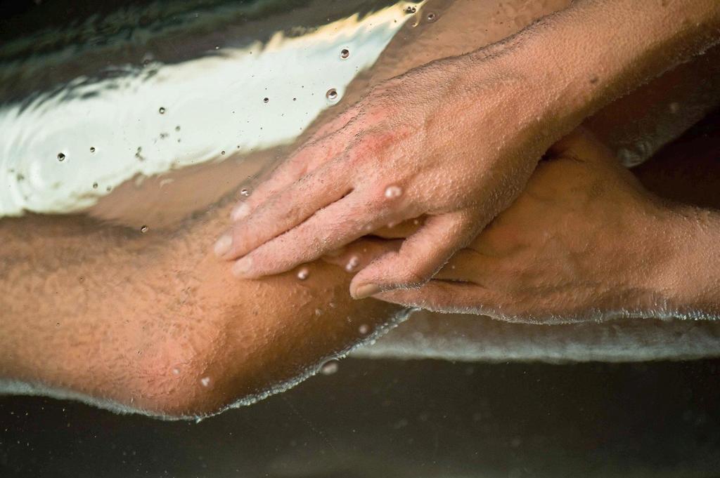 Reduce Hotel Thermal Adults Only باد تاتزماندورف المظهر الخارجي الصورة